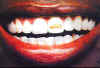 toyota_advert-teeth.jpg (9057 bytes)